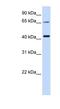 Glutaminyl-Peptide Cyclotransferase Like antibody, NBP1-62586, Novus Biologicals, Western Blot image 