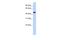 Gamma-Aminobutyric Acid Type A Receptor Rho2 Subunit antibody, A09525, Boster Biological Technology, Western Blot image 