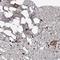 CUE Domain Containing 2 antibody, NBP1-88538, Novus Biologicals, Immunohistochemistry frozen image 