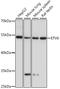 ETS Variant 6 antibody, A15668, ABclonal Technology, Western Blot image 