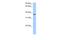 AlkB Homolog 8, TRNA Methyltransferase antibody, A09491, Boster Biological Technology, Western Blot image 