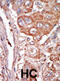 Fibroblast Growth Factor 4 antibody, abx033910, Abbexa, Immunohistochemistry frozen image 