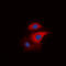 Ribosomal Protein S6 Kinase B1 antibody, LS-C368519, Lifespan Biosciences, Immunofluorescence image 