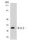 RALY Heterogeneous Nuclear Ribonucleoprotein antibody, LS-B11433, Lifespan Biosciences, Western Blot image 