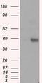 Protein-lysine 6-oxidase antibody, GTX84182, GeneTex, Western Blot image 