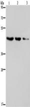 ELOVL Fatty Acid Elongase 6 antibody, TA351153, Origene, Western Blot image 