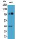 MPL Proto-Oncogene, Thrombopoietin Receptor antibody, A00483, Boster Biological Technology, Western Blot image 