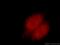 Retinoid X Receptor Alpha antibody, 21218-1-AP, Proteintech Group, Immunofluorescence image 