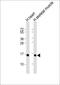 Tumor Suppressor 2, Mitochondrial Calcium Regulator antibody, M07508, Boster Biological Technology, Western Blot image 