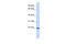 Zinc Finger Protein 581 antibody, 25-390, ProSci, Enzyme Linked Immunosorbent Assay image 