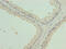Keratin 35 antibody, CSB-PA856422LA01HU, Cusabio, Immunohistochemistry paraffin image 