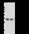Proteasome Activator Subunit 3 antibody, 14682-T62, Sino Biological, Western Blot image 