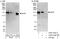 Elongator Complex Protein 1 antibody, A303-163A, Bethyl Labs, Western Blot image 