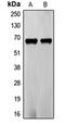 Frizzled Class Receptor 5 antibody, orb214762, Biorbyt, Western Blot image 