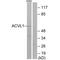 Activin A Receptor Like Type 1 antibody, A01468-1, Boster Biological Technology, Western Blot image 