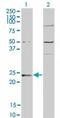 Guanylate Kinase 1 antibody, TA336961, Origene, Western Blot image 