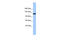 Testis Expressed 2 antibody, 30-521, ProSci, Enzyme Linked Immunosorbent Assay image 