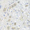 Serine Hydroxymethyltransferase 1 antibody, 23-135, ProSci, Immunohistochemistry paraffin image 