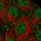 Synaptonemal Complex Protein 2 antibody, HPA062401, Atlas Antibodies, Immunocytochemistry image 