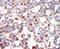 Mitogen-Activated Protein Kinase Kinase Kinase 7 antibody, PA5-15149, Invitrogen Antibodies, Immunohistochemistry paraffin image 