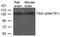 Neurotrophic Receptor Tyrosine Kinase 1 antibody, 79-501, ProSci, Western Blot image 