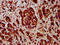 Semaphorin 3F antibody, LS-C681289, Lifespan Biosciences, Immunohistochemistry paraffin image 