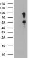 Serine Peptidase Inhibitor, Kunitz Type 1 antibody, TA504793, Origene, Western Blot image 