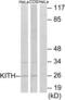 Thymidine Kinase 1 antibody, LS-C822550, Lifespan Biosciences, Western Blot image 