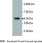 5'-Nucleotidase Ecto antibody, MBS355206, MyBioSource, Western Blot image 