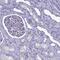 Solute Carrier Family 1 Member 6 antibody, PA5-59600, Invitrogen Antibodies, Immunohistochemistry frozen image 