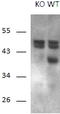 Regulator Of Calcineurin 1 antibody, STJ72487, St John
