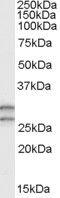 Catechol-O-Methyltransferase antibody, PA5-18330, Invitrogen Antibodies, Western Blot image 