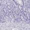 Advillin antibody, NBP2-34118, Novus Biologicals, Immunohistochemistry paraffin image 