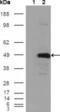 Betaine--Homocysteine S-Methyltransferase antibody, abx010466, Abbexa, Enzyme Linked Immunosorbent Assay image 
