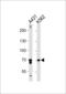 Prostaglandin-Endoperoxide Synthase 1 antibody, 61-529, ProSci, Western Blot image 