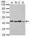 Proteasome 26S Subunit, Non-ATPase 6 antibody, GTX115303, GeneTex, Western Blot image 