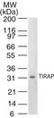 TIR Domain Containing Adaptor Protein antibody, GTX13684, GeneTex, Western Blot image 