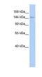 Diphosphoinositol Pentakisphosphate Kinase 2 antibody, NBP1-54642, Novus Biologicals, Western Blot image 