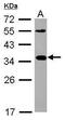 C-X-C Motif Chemokine Ligand 16 antibody, PA5-30786, Invitrogen Antibodies, Western Blot image 