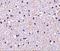 Nicastrin antibody, A03144, Boster Biological Technology, Immunohistochemistry paraffin image 