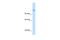 Carbamoyl-Phosphate Synthase 1 antibody, PA5-69380, Invitrogen Antibodies, Western Blot image 