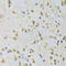 Autophagy Related 7 antibody, STJ22713, St John