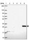 Chloride Intracellular Channel 2 antibody, NBP2-32516, Novus Biologicals, Western Blot image 