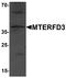 Mitochondrial Transcription Termination Factor 2 antibody, A12326, Boster Biological Technology, Western Blot image 