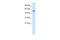 Smad Nuclear Interacting Protein 1 antibody, 27-894, ProSci, Enzyme Linked Immunosorbent Assay image 