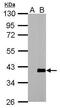 Actin Related Protein 2/3 Complex Subunit 1A antibody, PA5-28104, Invitrogen Antibodies, Western Blot image 