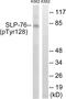 Lymphocyte Cytosolic Protein 2 antibody, PA5-39759, Invitrogen Antibodies, Western Blot image 