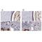 Serpin Family A Member 3 antibody, NBP1-90296, Novus Biologicals, Immunohistochemistry paraffin image 