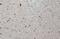 Integrin Subunit Beta 1 antibody, GTX128839, GeneTex, Immunohistochemistry paraffin image 