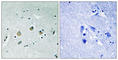 Mitogen-Activated Protein Kinase Kinase Kinase 8 antibody, abx012608, Abbexa, Western Blot image 